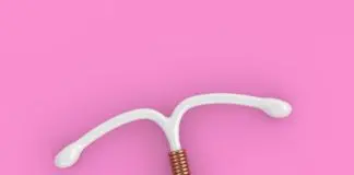 exemplo de DIU pelo SUS no modelo cobre.